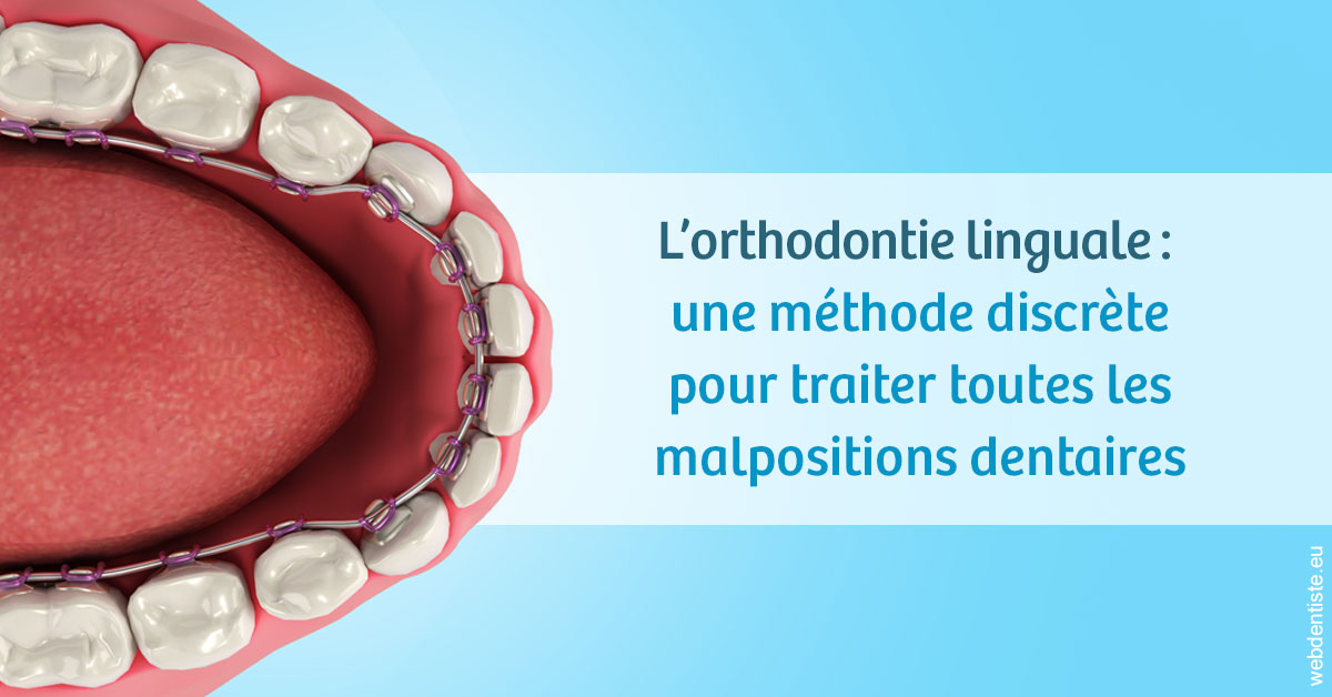 https://selarl-dentiste-drs-aouizerate.chirurgiens-dentistes.fr/L'orthodontie linguale 1
