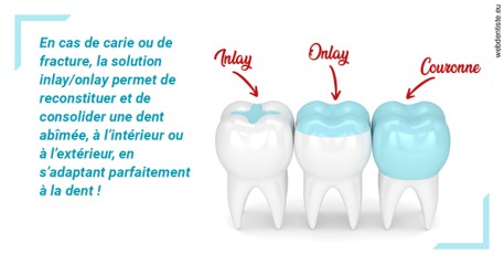 https://selarl-dentiste-drs-aouizerate.chirurgiens-dentistes.fr/L'INLAY ou l'ONLAY