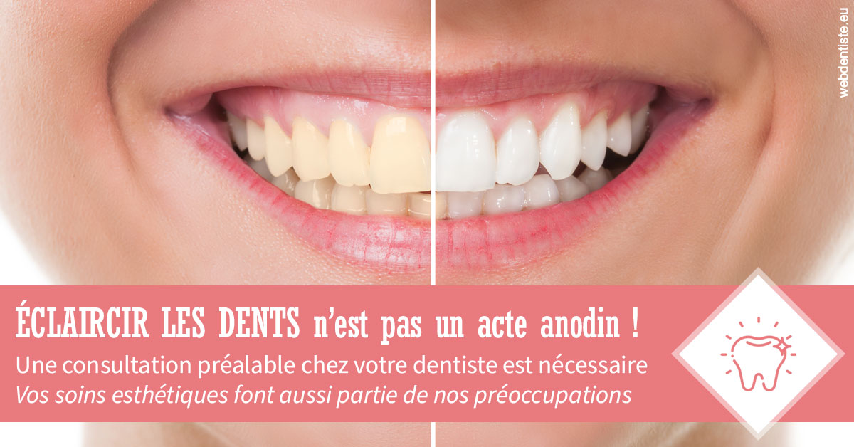 https://selarl-dentiste-drs-aouizerate.chirurgiens-dentistes.fr/Eclaircir les dents 1