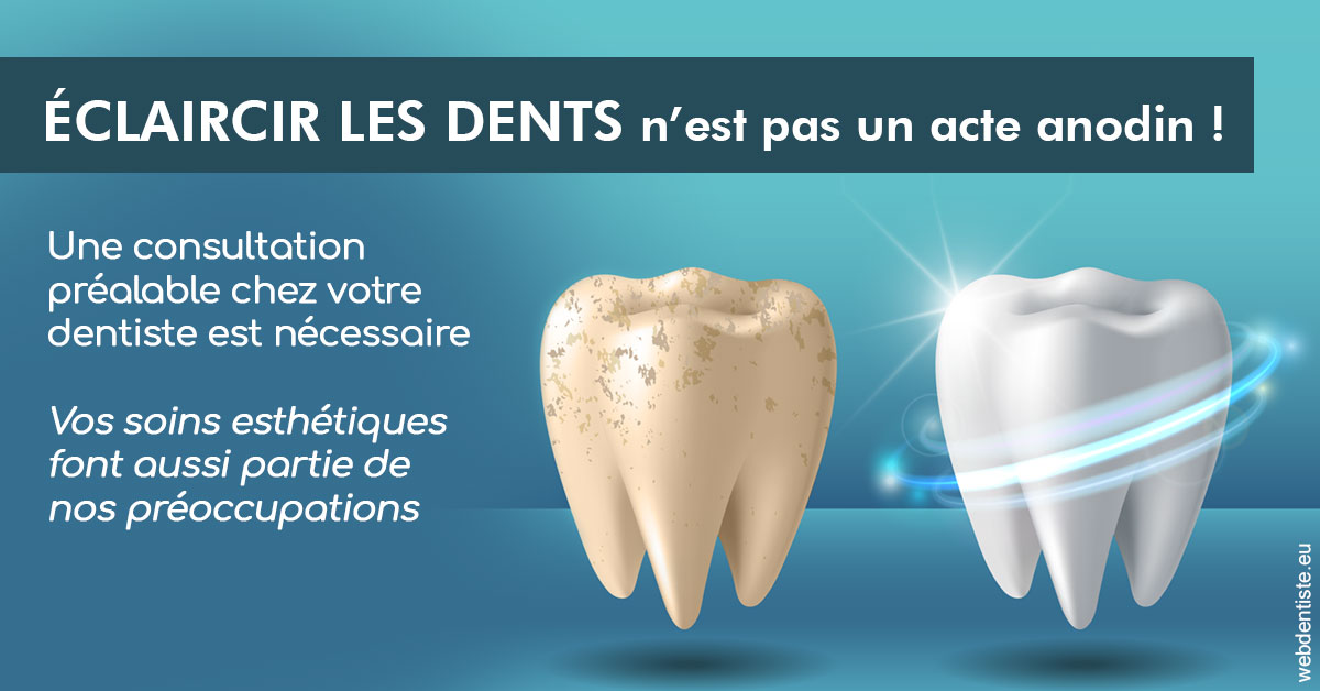 https://selarl-dentiste-drs-aouizerate.chirurgiens-dentistes.fr/Eclaircir les dents 2