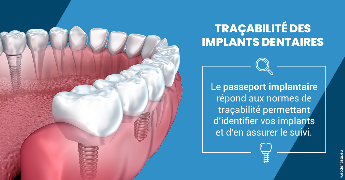 https://selarl-dentiste-drs-aouizerate.chirurgiens-dentistes.fr/T2 2023 - Traçabilité des implants 1