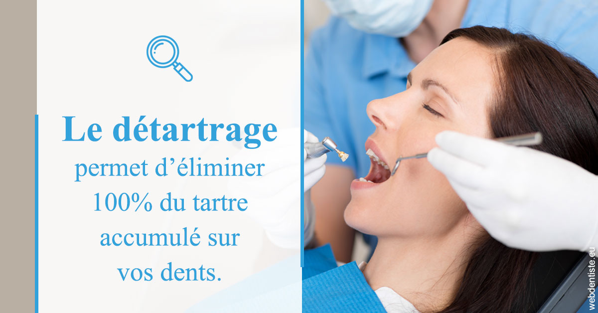 https://selarl-dentiste-drs-aouizerate.chirurgiens-dentistes.fr/En quoi consiste le détartrage