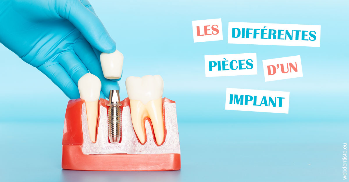 https://selarl-dentiste-drs-aouizerate.chirurgiens-dentistes.fr/Les différentes pièces d’un implant 2