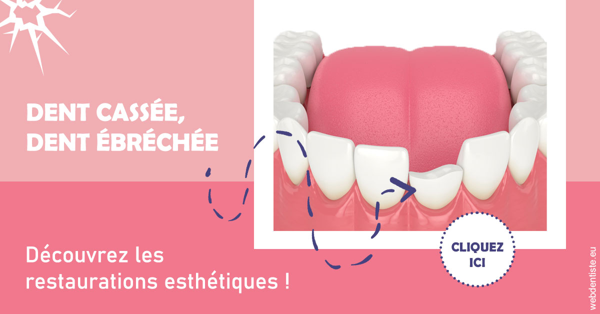 https://selarl-dentiste-drs-aouizerate.chirurgiens-dentistes.fr/Dent cassée ébréchée 1
