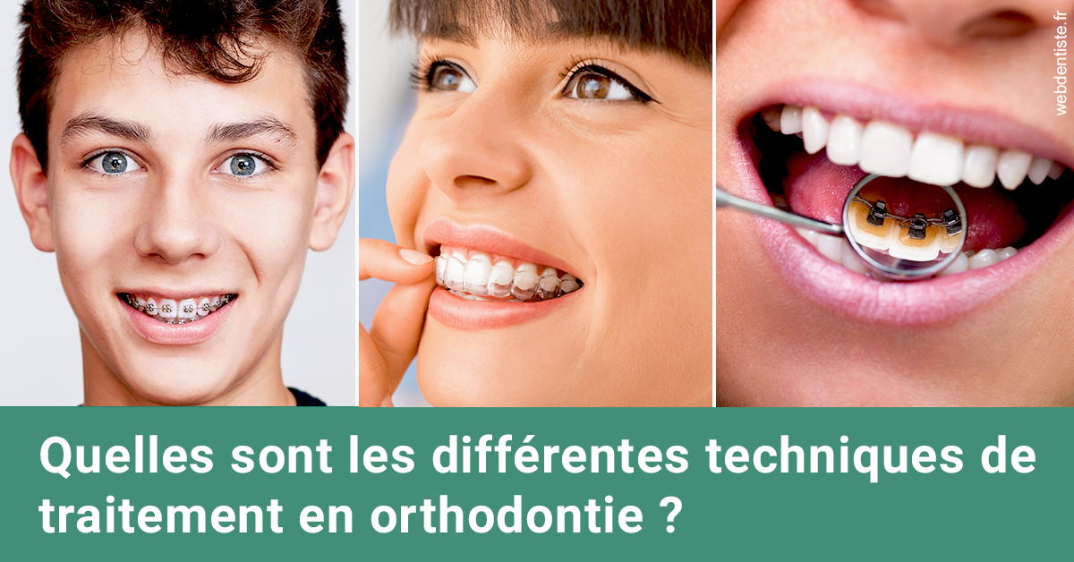 https://selarl-dentiste-drs-aouizerate.chirurgiens-dentistes.fr/Les différentes techniques de traitement 2