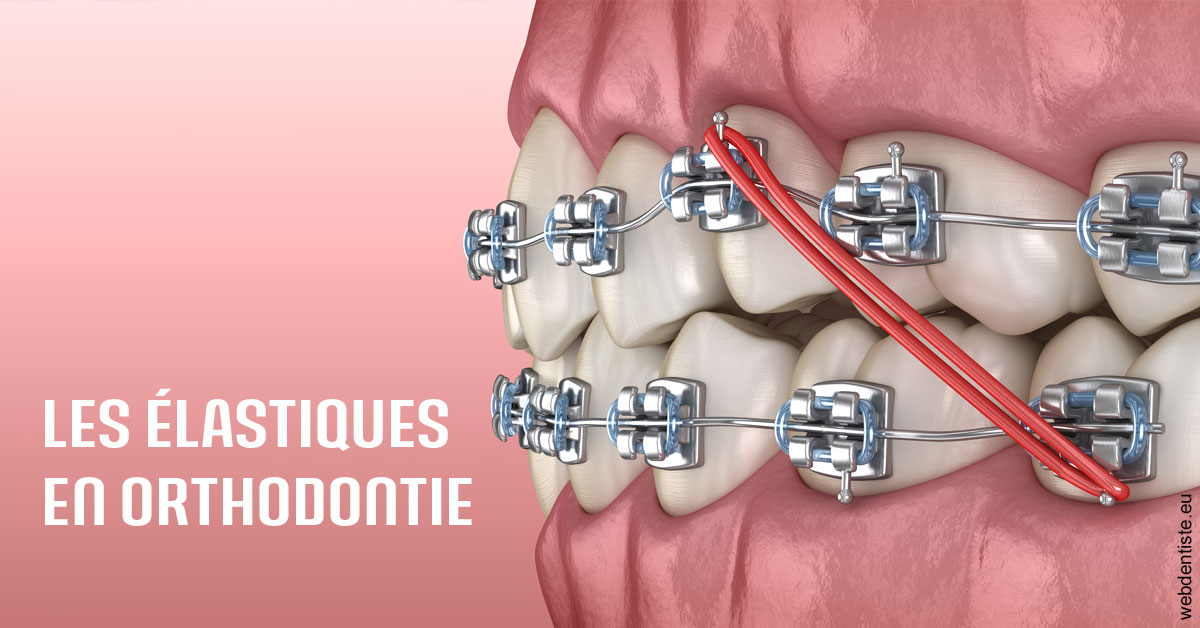 https://selarl-dentiste-drs-aouizerate.chirurgiens-dentistes.fr/Elastiques orthodontie 2