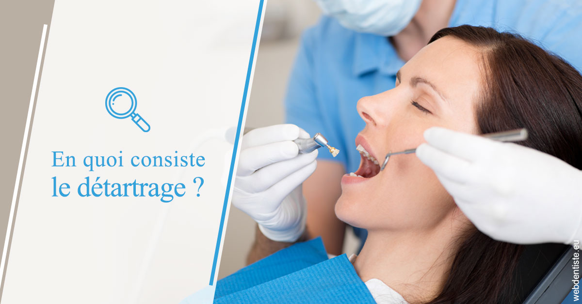 https://selarl-dentiste-drs-aouizerate.chirurgiens-dentistes.fr/En quoi consiste le détartrage